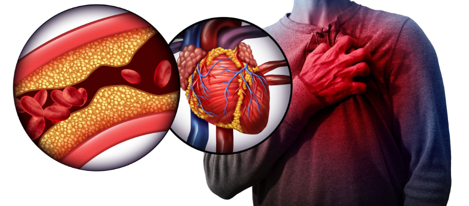 CardioBalance Bewertungen – Beruhigt Ihr Herz und stabilisiert den Blutdruck, Preis!